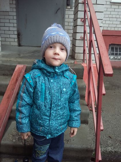 парез лицевого нерва, птоз и долгожданная операция