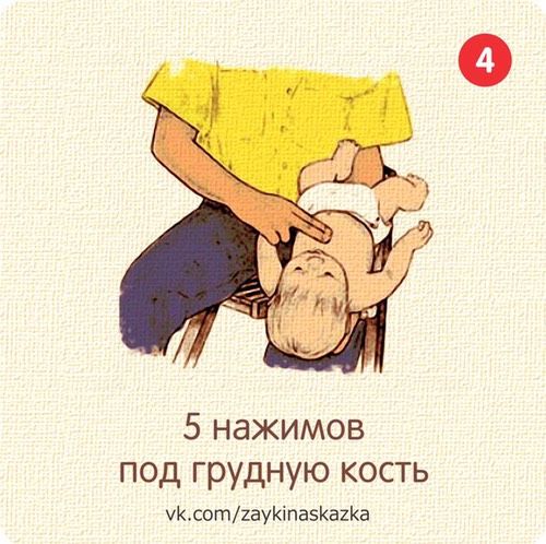 Что делать, если ребёнок подавился???