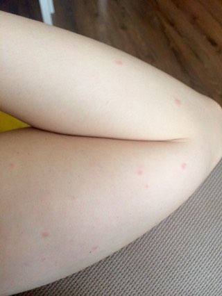 Кто разбирается в аллергии, посмотрите))