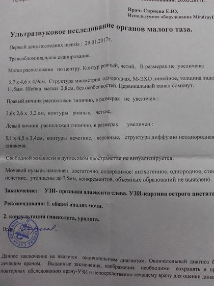 Результат узи