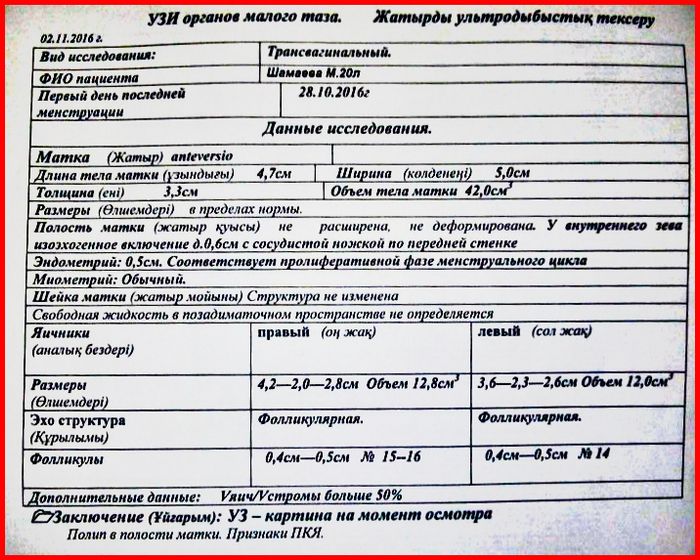 сделала УЗИ органов малого таза и комплексное.