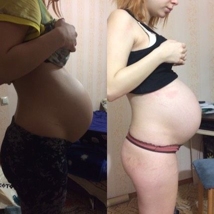 Живот