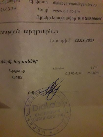 АНАЛИЗ ТТГ