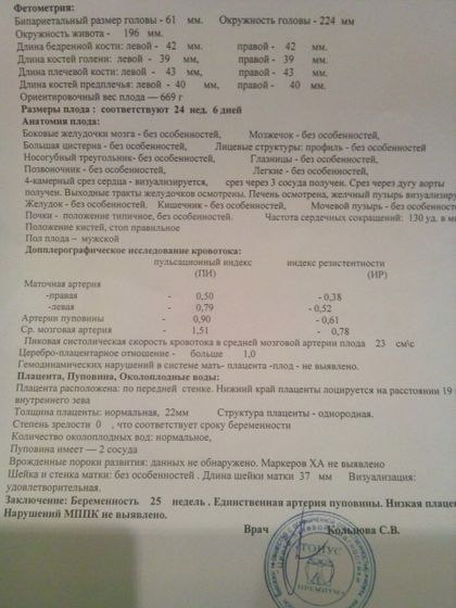 Единичная артерия пуповины