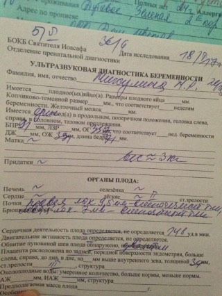 Обвитие