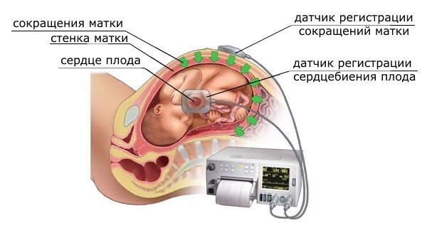 Сердцебиение плода на разных сроках беременности