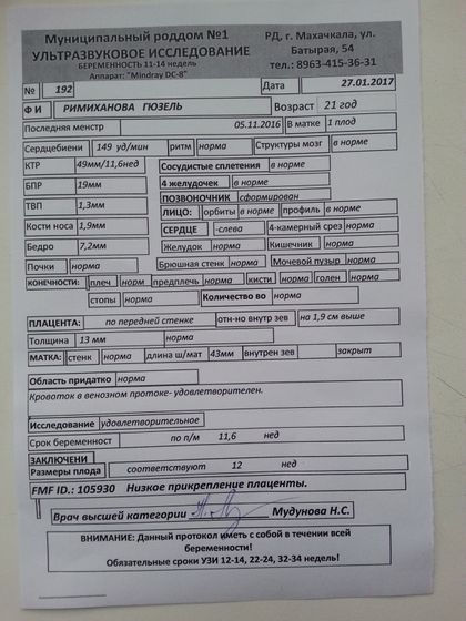 Узи