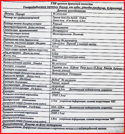 сделала УЗИ органов малого таза и комплексное.