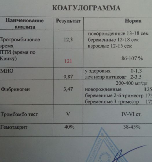 Коагулограмма