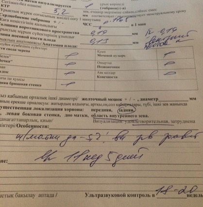 Гадание по чсс!)))