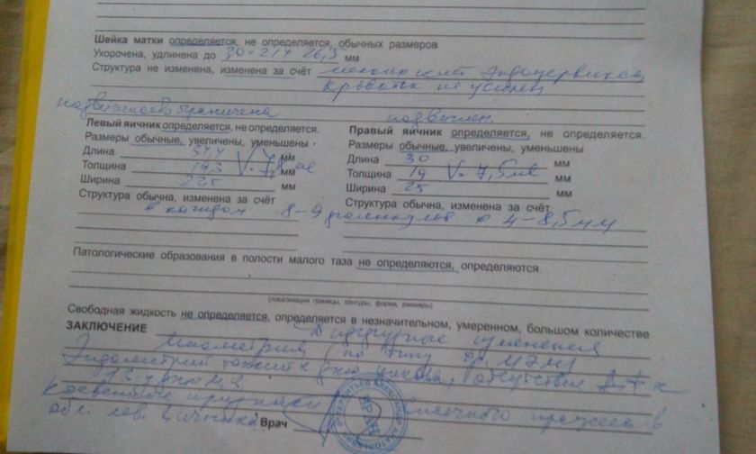 Сходила на узи.