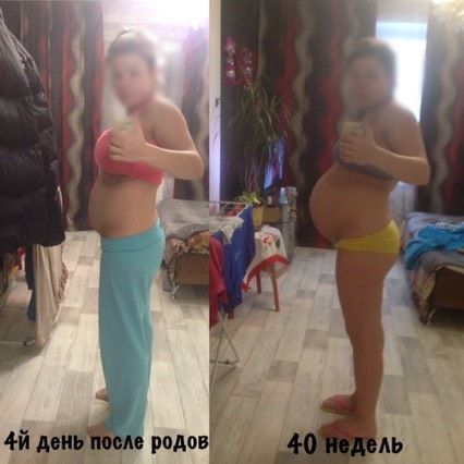 Восстановление после родов ?.Опять