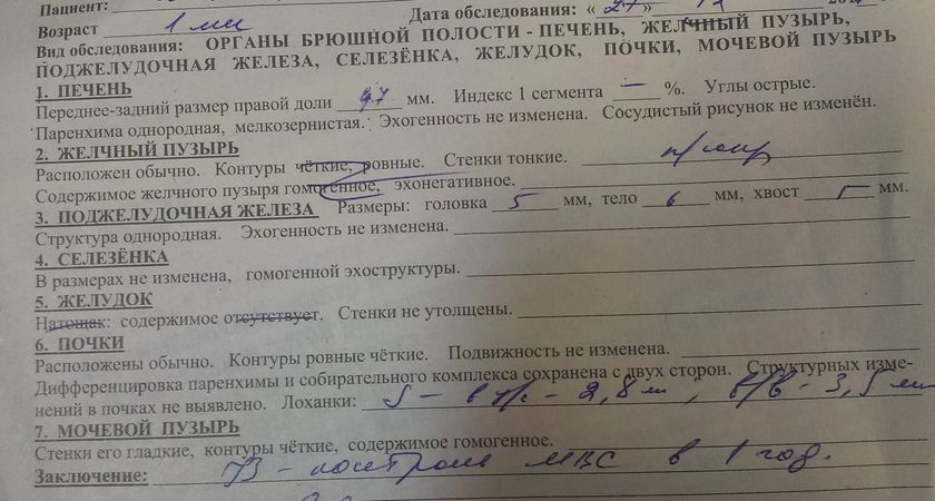 Здравствуйте! Помогите расшифровать узи почек...