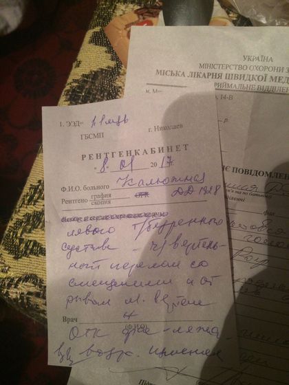 замена тазобедренного сустава в пожилом возрасте?!