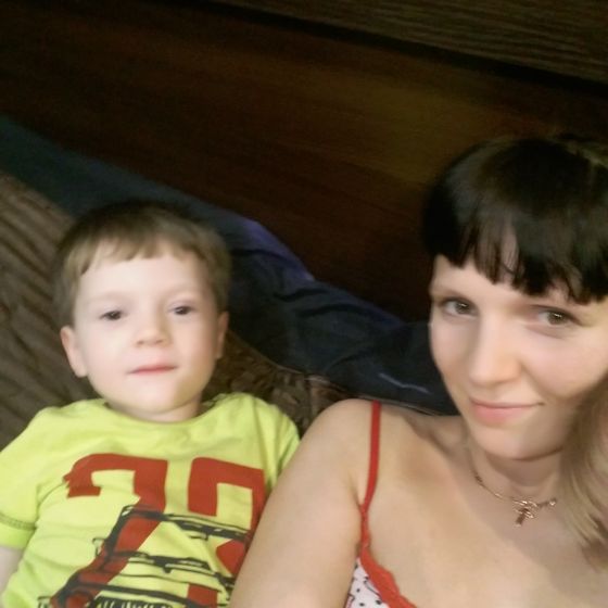 парез лицевого нерва, птоз и долгожданная операция