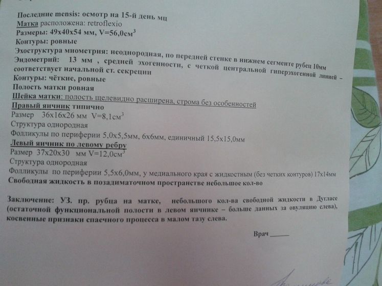 Была на УЗИ!